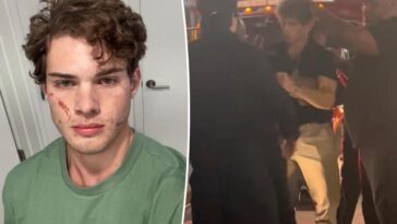 'Looksmaxxing' influencer Clavicular addresses 'brutal' hospitalization after suspected overdose on livestream