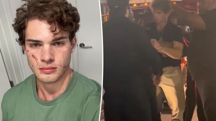 'Looksmaxxing' influencer Clavicular addresses 'brutal' hospitalization after suspected overdose on livestream