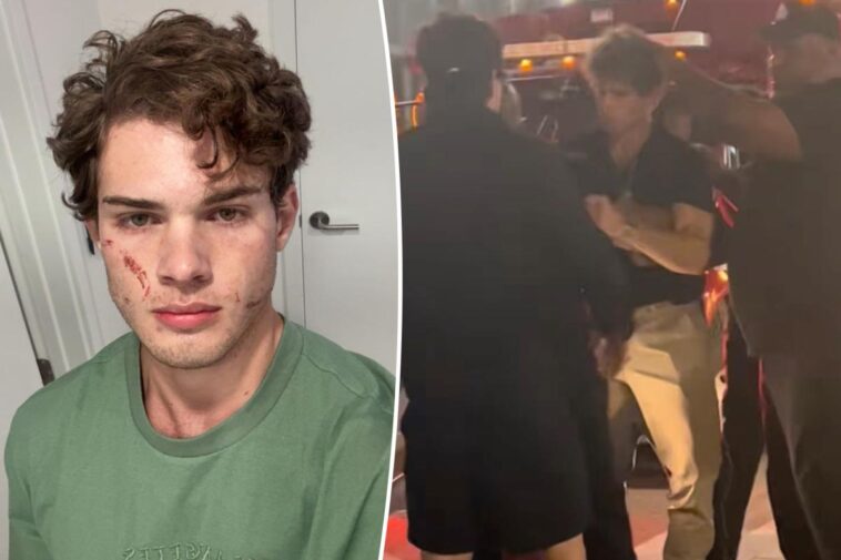 'Looksmaxxing' influencer Clavicular addresses 'brutal' hospitalization after suspected overdose on livestream