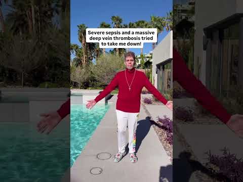 Making Progress Again! | Perez Hilton