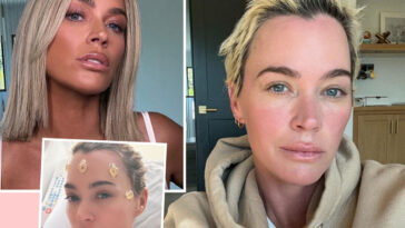 Unfiltered! Teddi Mellencamp Shares Photo Of Brain Surgery Scars As She Asks For Help Amid Cancer Battle