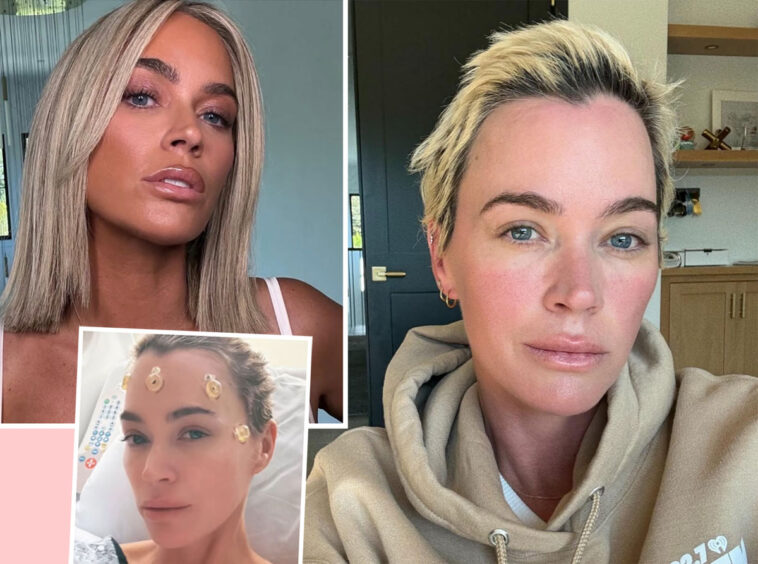 Unfiltered! Teddi Mellencamp Shares Photo Of Brain Surgery Scars As She Asks For Help Amid Cancer Battle